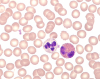 RAPID STAINING OF BLOOD SMEAR STAINING S